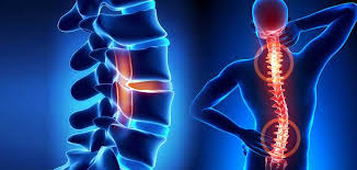 Neck and Cervical Pain Treatment